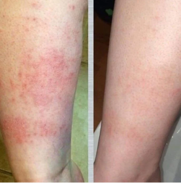 Whipped tallow face cream and balm showing smoother, more even arm skin tone