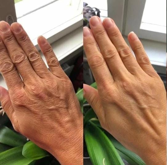 Face cream and balm on hands with fingers extended